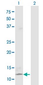 FGF5 Antibody in Western Blot (WB)