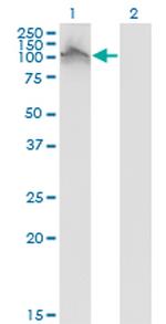 FGFR2 Antibody in Western Blot (WB)