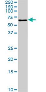 FGR Antibody in Western Blot (WB)