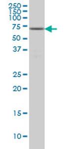 FGR Antibody in Western Blot (WB)