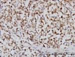 FH Antibody in Immunohistochemistry (Paraffin) (IHC (P))