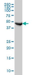 FH Antibody in Western Blot (WB)