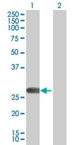 FHL2 Antibody in Western Blot (WB)