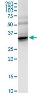 FHL2 Antibody in Western Blot (WB)