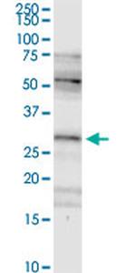 FHL2 Antibody in Western Blot (WB)