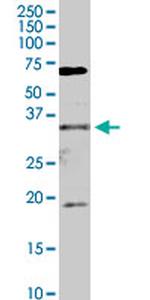 FHL2 Antibody in Western Blot (WB)