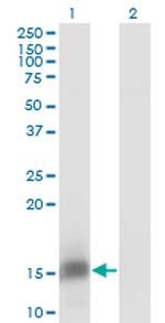 FKBP1B Antibody in Western Blot (WB)