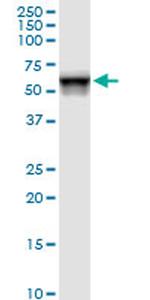 FKBP4 Antibody in Western Blot (WB)