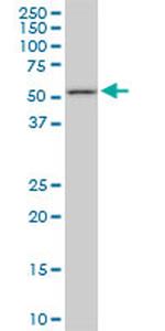 FKBP4 Antibody in Western Blot (WB)