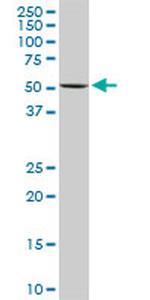 FKBP4 Antibody in Western Blot (WB)