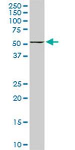 FKBP4 Antibody in Western Blot (WB)