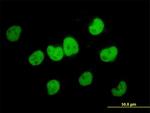 FKBP5 Antibody in Immunocytochemistry (ICC/IF)