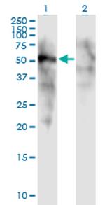 FOXD1 Antibody in Western Blot (WB)