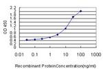 FOXC2 Antibody in ELISA (ELISA)