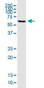 FOXC2 Antibody in Western Blot (WB)