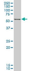 FOXC2 Antibody in Western Blot (WB)