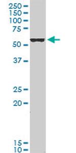 FOXC2 Antibody in Western Blot (WB)