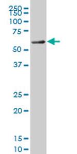 FOXC2 Antibody in Western Blot (WB)