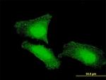 FOXO1A Antibody in Immunocytochemistry (ICC/IF)