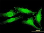 FOXO1A Antibody in Immunocytochemistry (ICC/IF)