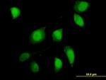 FOXO1A Antibody in Immunocytochemistry (ICC/IF)