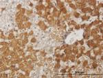 FOXO1A Antibody in Immunohistochemistry (Paraffin) (IHC (P))