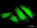 FOXO3A Antibody in Immunocytochemistry (ICC/IF)