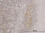 FOXO3A Antibody in Immunohistochemistry (Paraffin) (IHC (P))