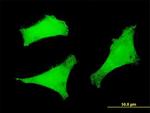 FOXO3A Antibody in Immunocytochemistry (ICC/IF)