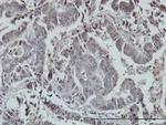 FOXO3A Antibody in Immunohistochemistry (Paraffin) (IHC (P))