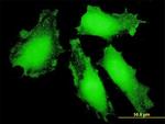 FOXO3A Antibody in Immunocytochemistry (ICC/IF)