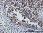 FOXO3A Antibody in Immunohistochemistry (Paraffin) (IHC (P))