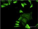 FLNA Antibody in Immunocytochemistry (ICC/IF)