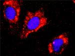 FLT1 Antibody in Proximity Ligation Assay (PLA) (PLA)