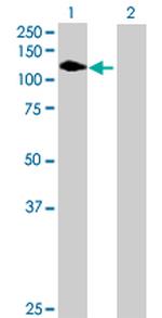 FLT1 Antibody in Western Blot (WB)