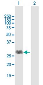 FNTA Antibody in Western Blot (WB)