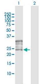 FOLR1 Antibody in Western Blot (WB)