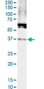 FPR2 Antibody in Western Blot (WB)