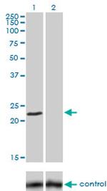 FXN Antibody in Western Blot (WB)