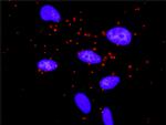 MTOR Antibody in Proximity Ligation Assay (PLA) (PLA)