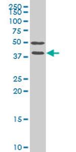 FRZB Antibody in Western Blot (WB)