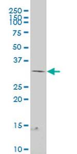 FRZB Antibody in Western Blot (WB)