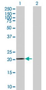 FTH1 Antibody in Western Blot (WB)