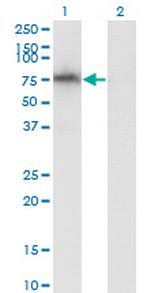 ADAM2 Antibody in Western Blot (WB)