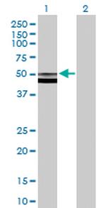 FUCA2 Antibody in Western Blot (WB)