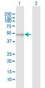 FUCA2 Antibody in Western Blot (WB)