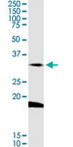 DARC Antibody in Western Blot (WB)