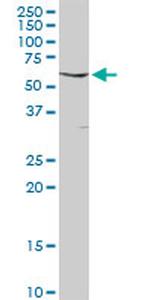 FYN Antibody in Western Blot (WB)