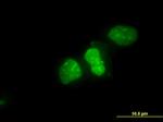 XRCC6 Antibody in Immunocytochemistry (ICC/IF)