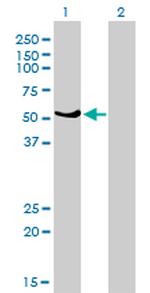 GABPA Antibody in Western Blot (WB)